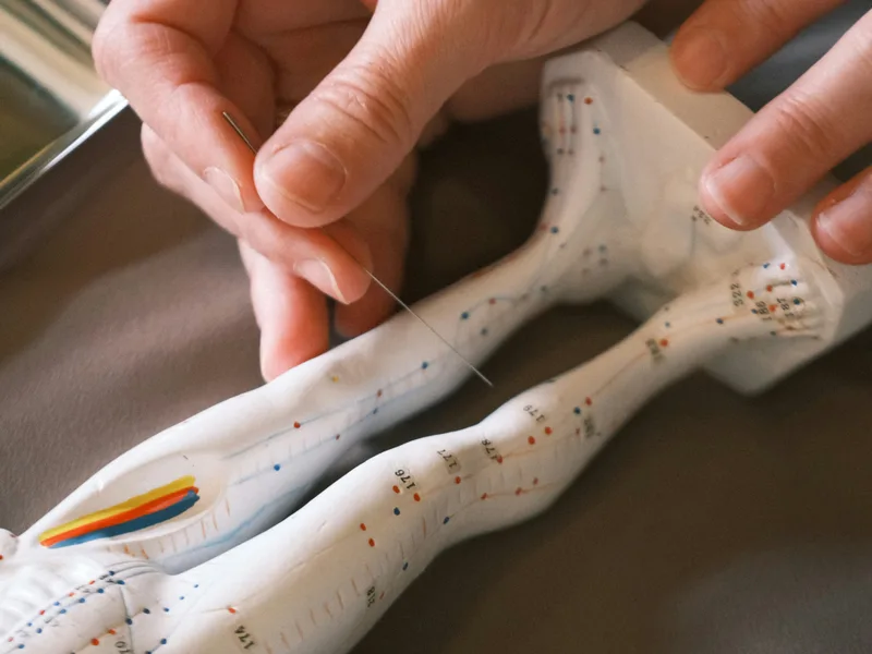 Acupuncture at Wellness Revolution in Evanston