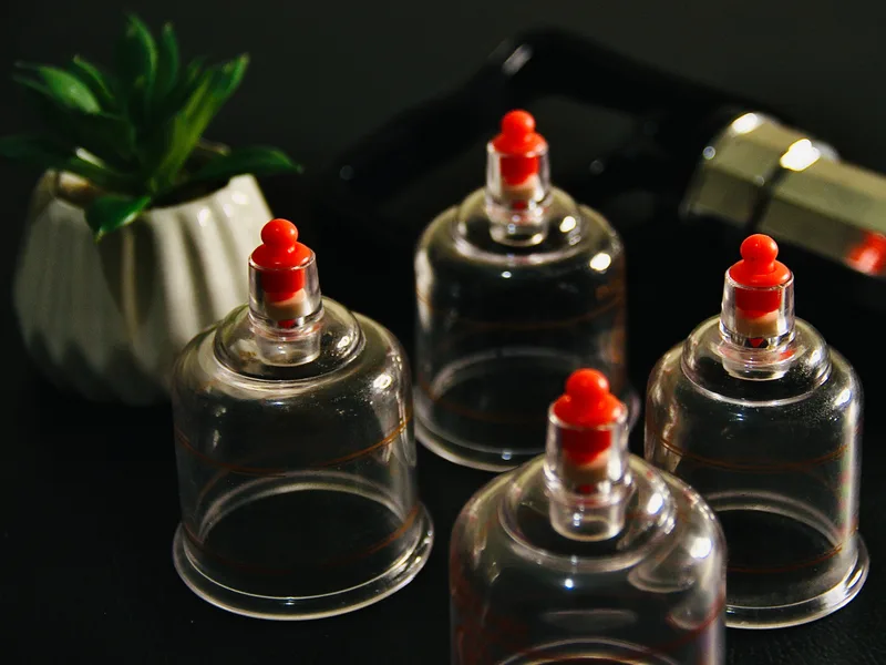 How Cupping Therapy works at Wellness Revolution