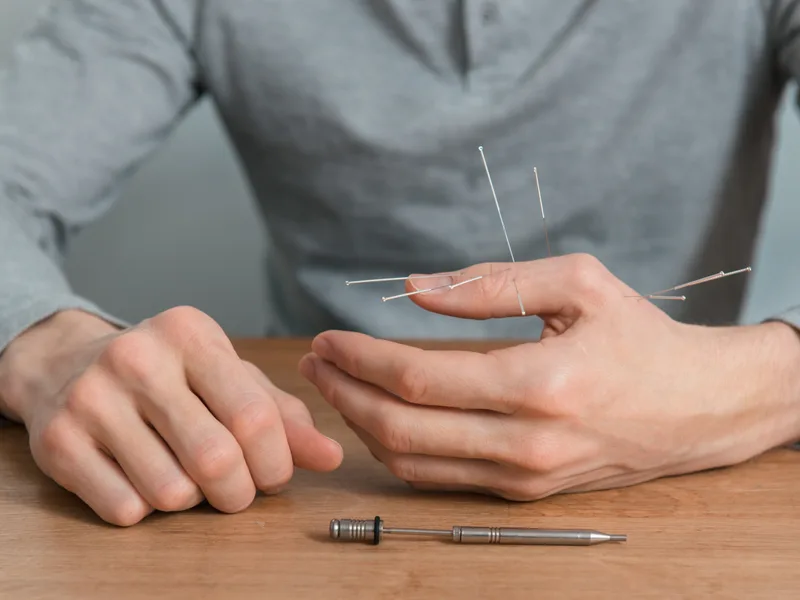 Dry Needling at Wellness Revolution in Evanston