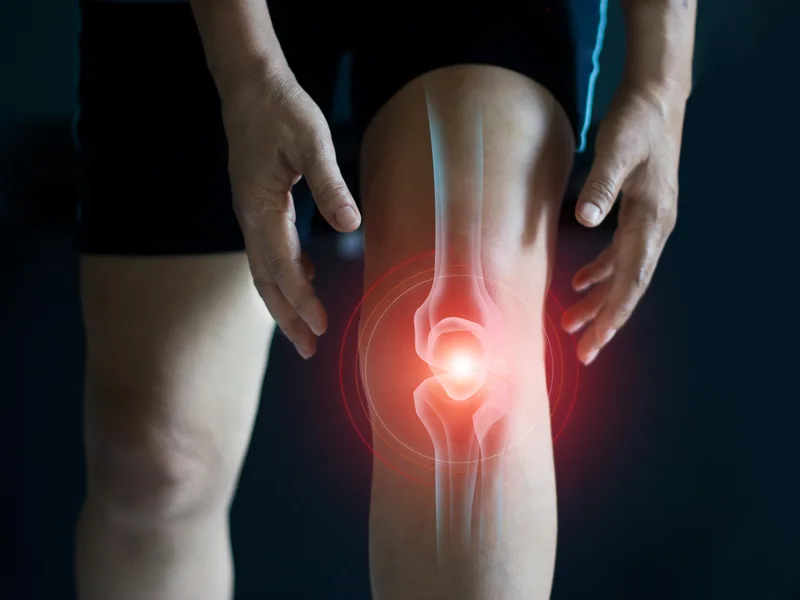 How Wellness Revolution treats arthritis in Evanston